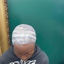 Scalp Treatment