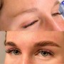 Eyebrow: Microblading