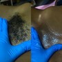 First Time Brazilian Wax (Extractions)