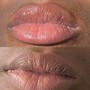 Microneedling- LIP NEUTRALIZATION/LIP PLUMP