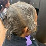 Scalp Treatment