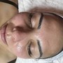 4 Lunchtime Chemical peel