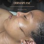 Dermaplaning Facial