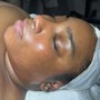 Acne Facial