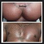 Brazilian Wax (Female)