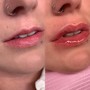 Hyaluronic Needless Lip Filler touch up