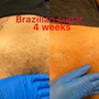 Brazilian Wax