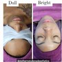 Newbie Facial