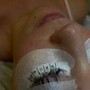 Eyelash Extension Removal