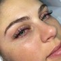 Eyelash Extension Removal