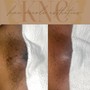 Glow Below Treatment (Men’s)