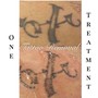 Laser Tattoo Removal On Small Area 5cmx10cm