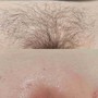 Men’s Brazilian Wax