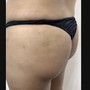 Body Tightening Sculpting Massage w/ Butt Lift