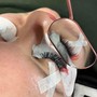 Eyelash Extension Removal