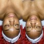 Facial