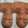 Facial