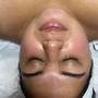 Facial