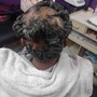 Scalp Treatment