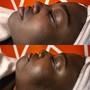 Neck and Chest firming treatment