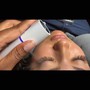 Lash Removal