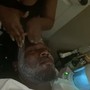 Scalp Treatment