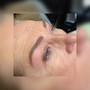 Dermaplaning facial treatment