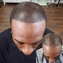 SCALP MICROPIGMENTATION [SMP] starting at $700 [CALL FOR ESTIMATE] AND BOOK APPOINTMENTS...200 DEPOSIT REQUIRED