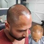 SCALP MICROPIGMENTATION [SMP] starting at $700 [CALL FOR ESTIMATE] AND BOOK APPOINTMENTS...200 DEPOSIT REQUIRED