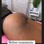 Body Tightening Sculpting Massage w/ Butt Lift