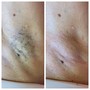 Underarm Wax