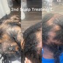 Scalp Treatment