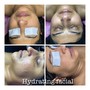 Microdermabrasion