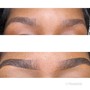 Eyebrow Shaping