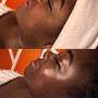 Neck and Chest firming treatment