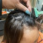 Scalp Treatment