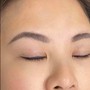 Eyebrows Laser Tattoo Removal