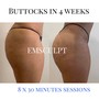 Bottocks/Bikini line/Underarm or Neck