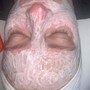 Dermaplaning Facial