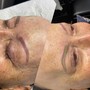 Dermaplaning facial treatment