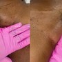 Underarm Wax