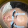 Eyelash Extension Removal