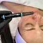 Microdermabrasion