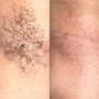 Underarm Wax