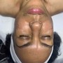 Dermaplaning Facial