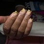 Nail Repair