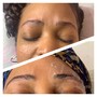 Permanent Makeup Removal