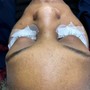 Eyelash Extension Removal