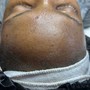 Facial