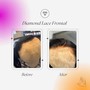 Diamond Lace Closure Install/Sew In